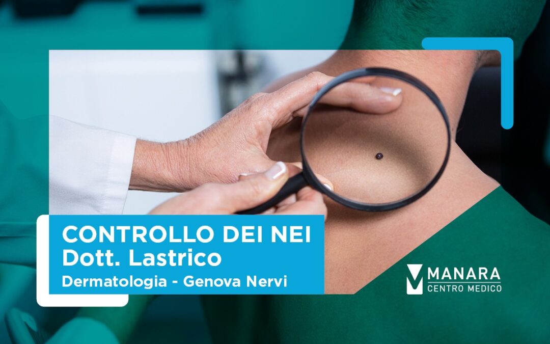 Estate e controllo dei nei: un appuntamento importante